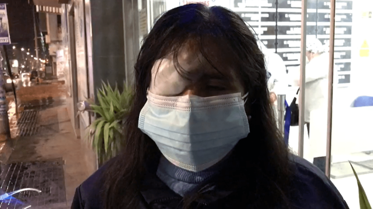 Junín: regidora es atacada con lejía y podría perder el ojo